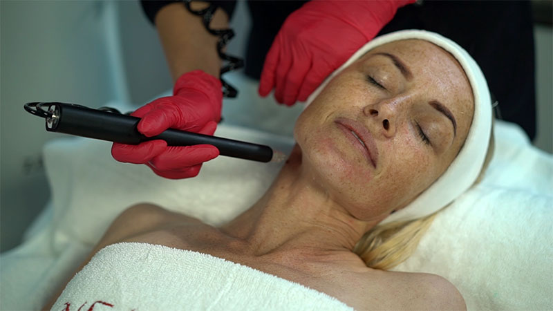 zaffiro hautstraffung