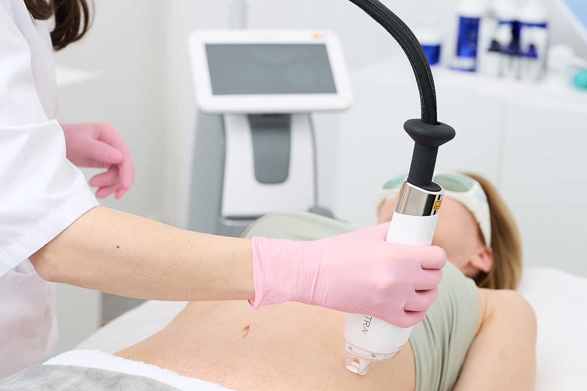 LaseMD Ultra Bauchbehandlung in Berlin-Mitte