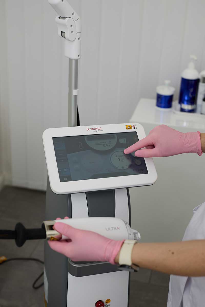 LaseMD Ultra Display und Bedienung bei My Perfect Face Berlin-Mitte