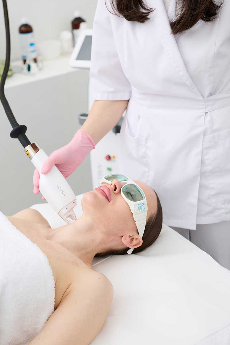 LaseMD Ultra Halsbereich Behandlung in Berlin-Mitte bei My Perfect Face
