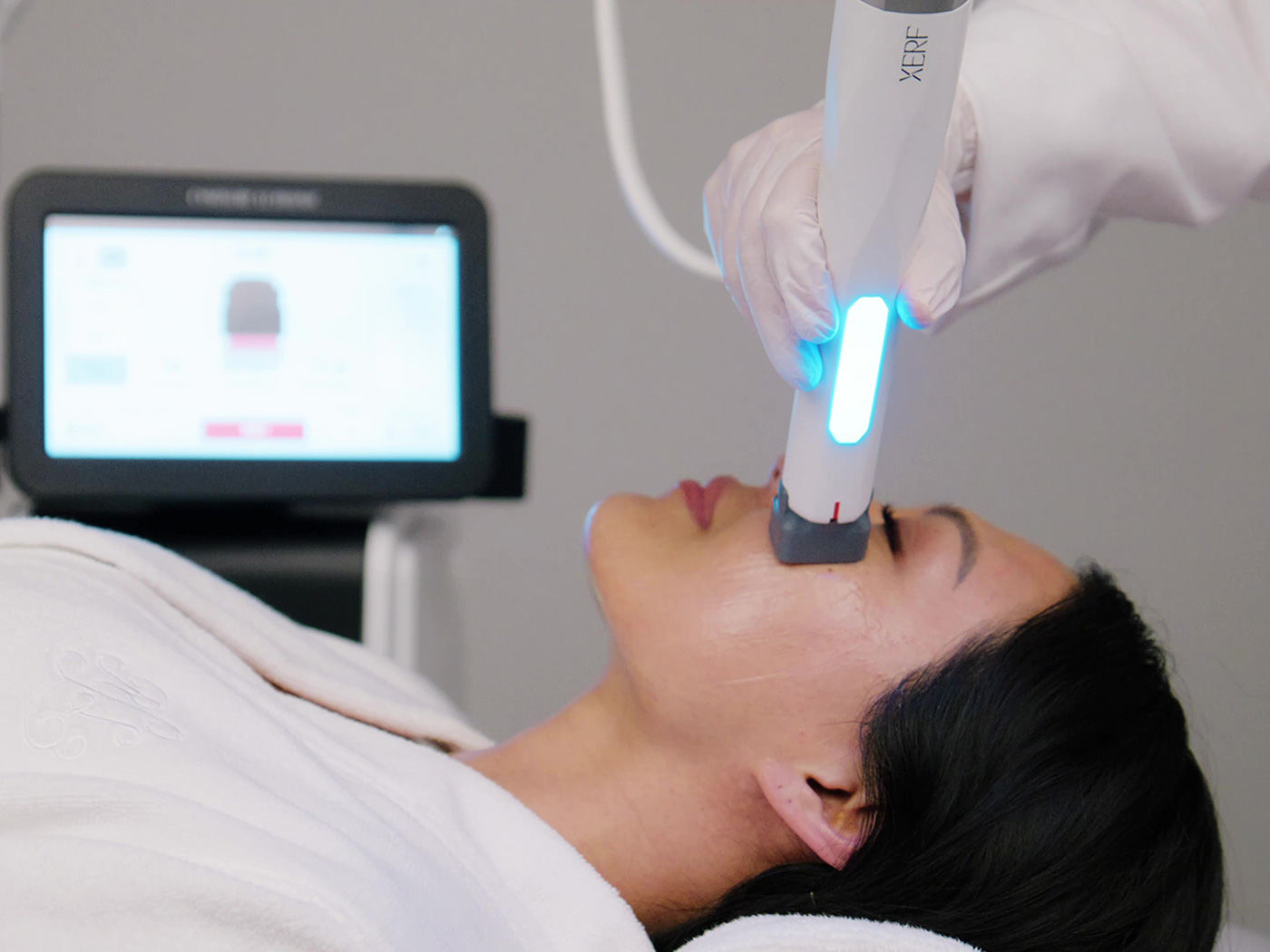 Beispiel einer XERF Radiofrequenzanwendung mit Behandlungskopf